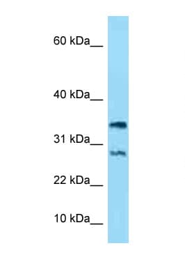 NDUFA11 / B14.7 Antibody (aa15-64)