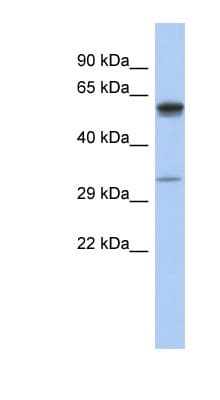 Polyclonal Rabbit anti-Human ZDHHC24 Antibody (C-Terminus, WB)