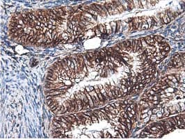 Latexin / MUM Antibody (clone OTI1E10)