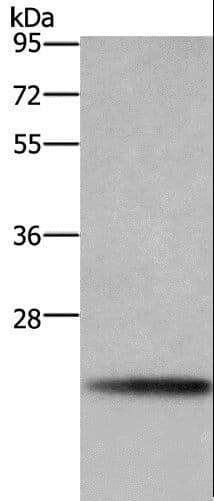 Polyclonal Rabbit anti-Human BBC3 / PUMA Antibody (WB)