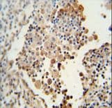 SYNCAM / CADM1 Antibody (aa66-94)