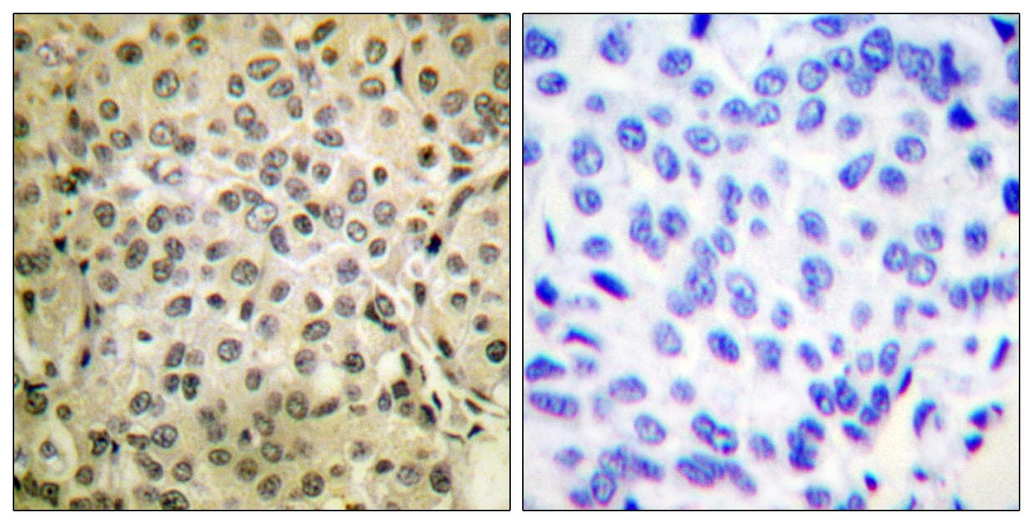 Polyclonal Rabbit anti-Human SMAD3 Antibody (p425, IHC, WB)