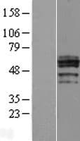 CHST6 Protein (Over-Expression Lysate Myc-DDK (Flag))