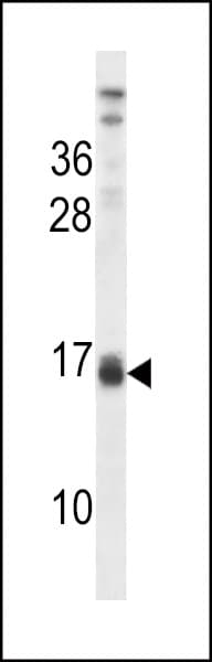 Polyclonal Rabbit anti-Human LALBA / Alpha Lactalbumin Antibody (aa39-68, IHC, WB)
