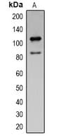 PARP1 Antibody