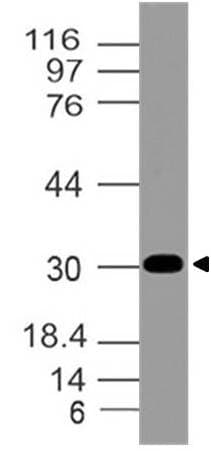 Polyclonal Rabbit anti-Human AIMP2 Antibody (WB)