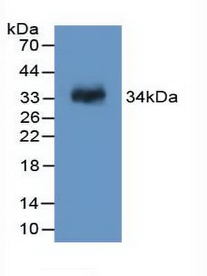 F13A1 / Factor XIIIa Antibody (aa140-377, Cy3)