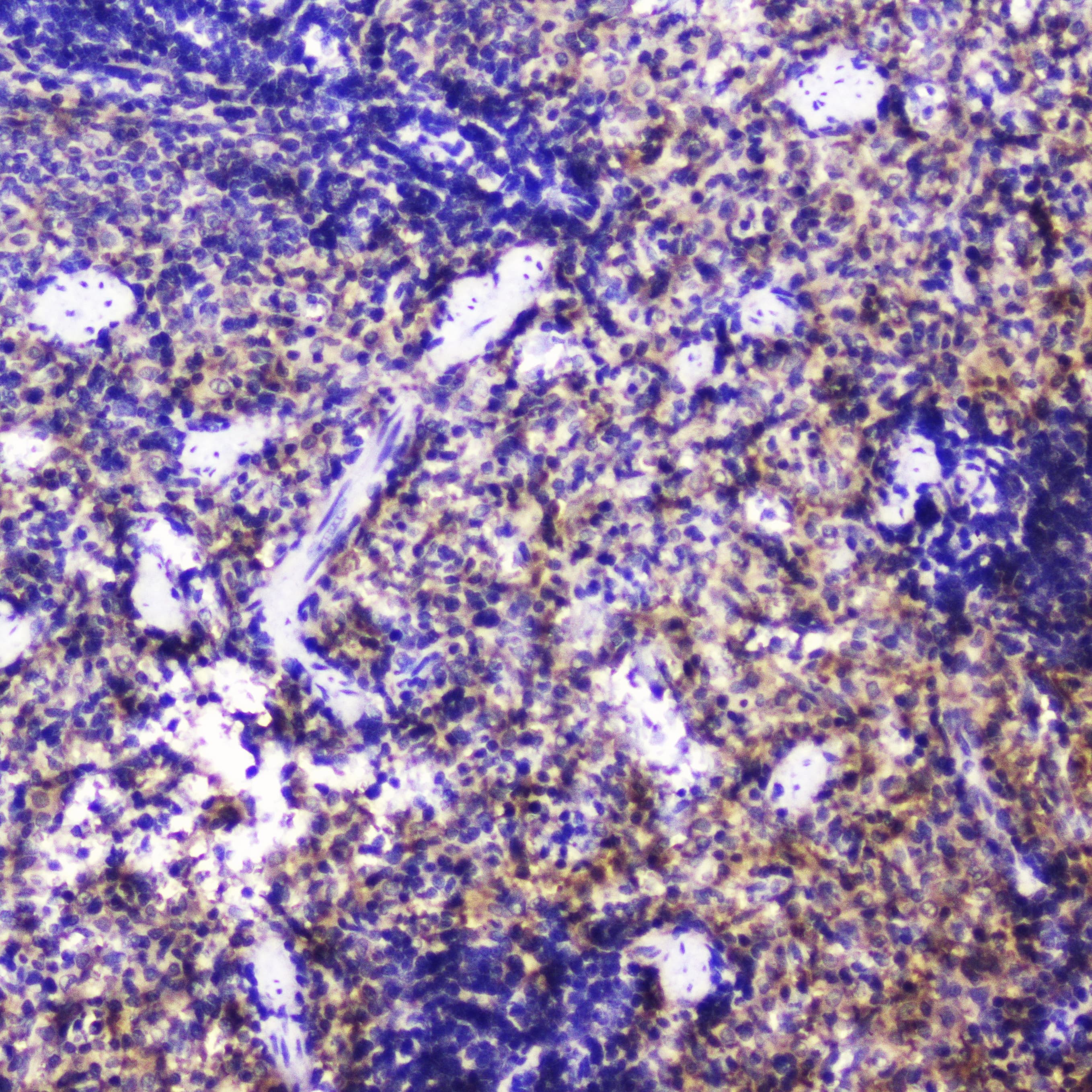 TLN1 / Talin 1 Antibody