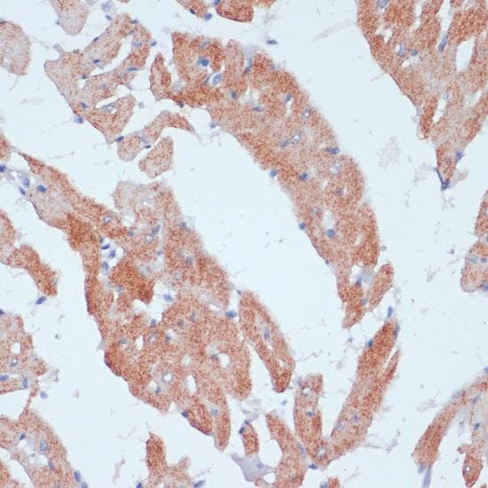 Polyclonal Rabbit anti-Human ACSL3 Antibody (IHC)