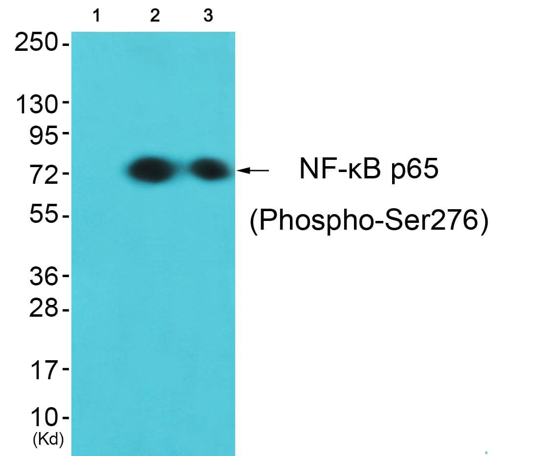 RELA / NFKB p65 Antibody (phospho-Ser276)