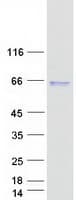 Human SERPINA10 / PZI Protein (Recombinant Myc-DDK (Flag))