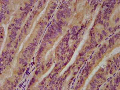 Polyclonal Rabbit anti-Human UGT1A6 Antibody (IHC)