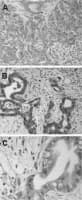 Polyclonal Rabbit anti-Human BAG3 / BAG-3 Antibody (C-Terminus, IHC, WB)