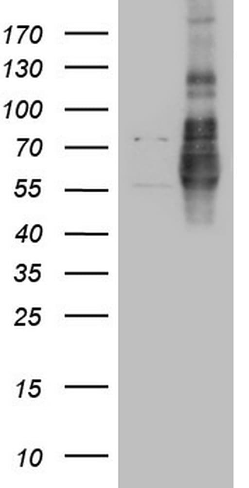 LPIN1 / Lipin 1 Antibody (clone OTI8F10)