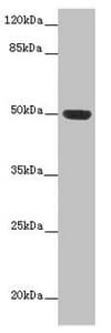 Polyclonal Rabbit anti-Human HTR3D / 5HT3D Receptor Antibody