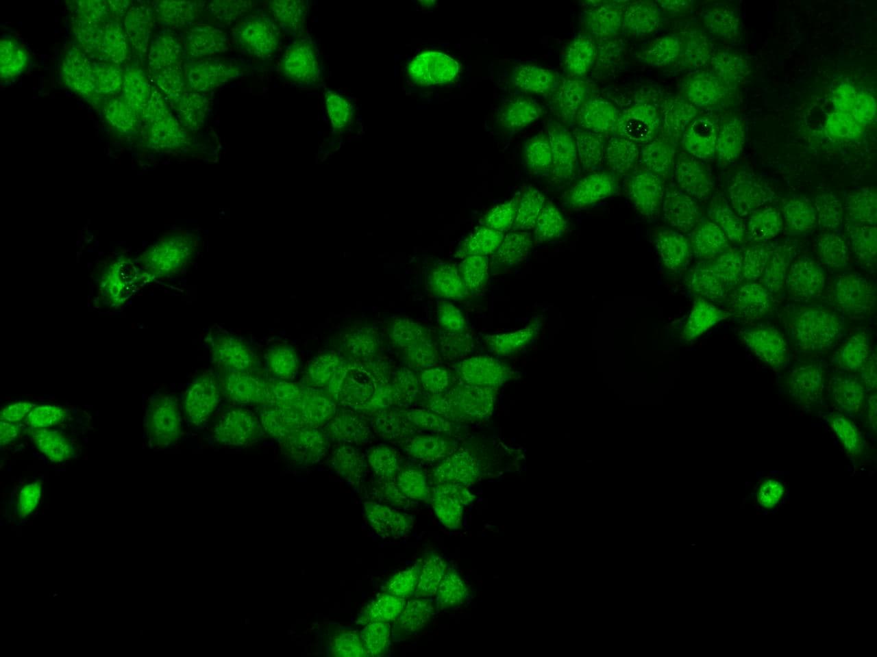 Polyclonal Rabbit anti-Human CCDC141 Antibody (IF)