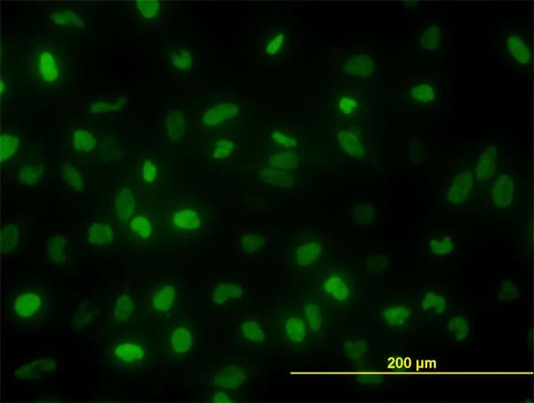 TOP2A / Topoisomerase II Alpha Antibody (clone 1E2)