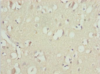 UBE1L2 / UBE1L2 Antibody