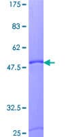 Human MYL6B Protein (Recombinant GST)