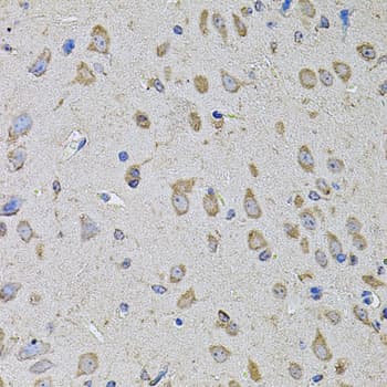 Polyclonal Rabbit anti-Human PTCD3 Antibody (IHC, WB)
