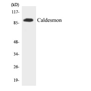 CALD1 / Caldesmon Antibody (aa704-753)
