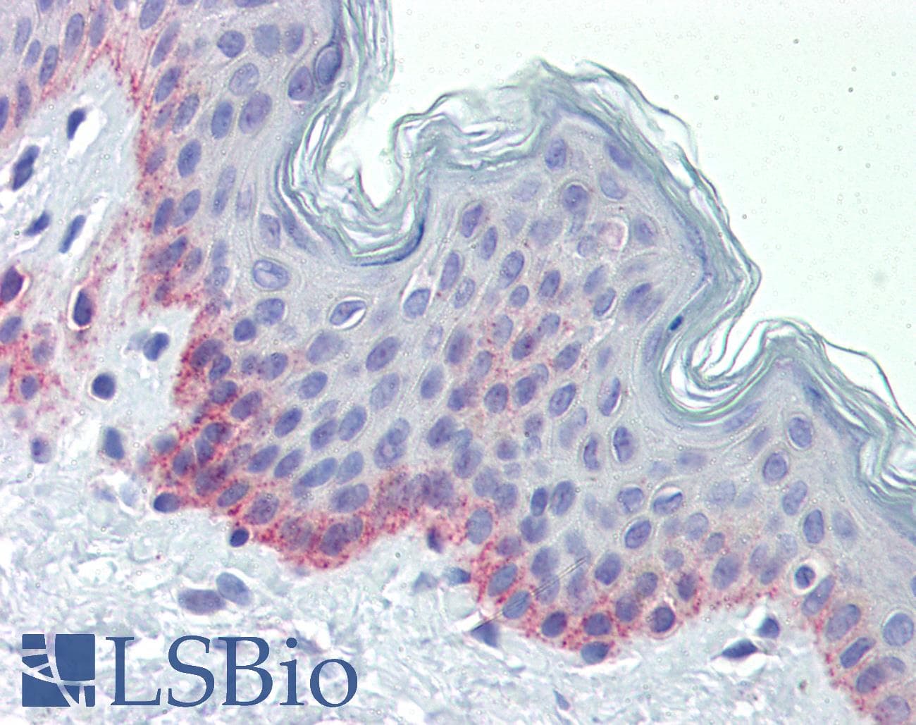 PNPT1 Antibody (aa489-538)