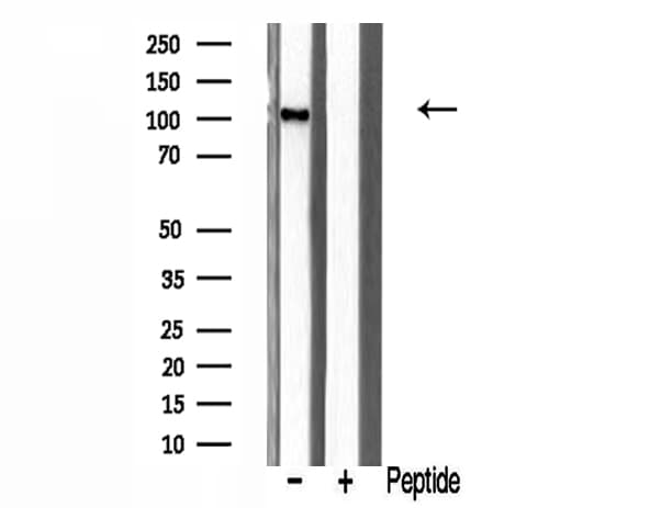 KAT2A / GCN5 Antibody