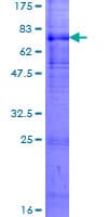 Human KX / XK Protein (Recombinant GST)