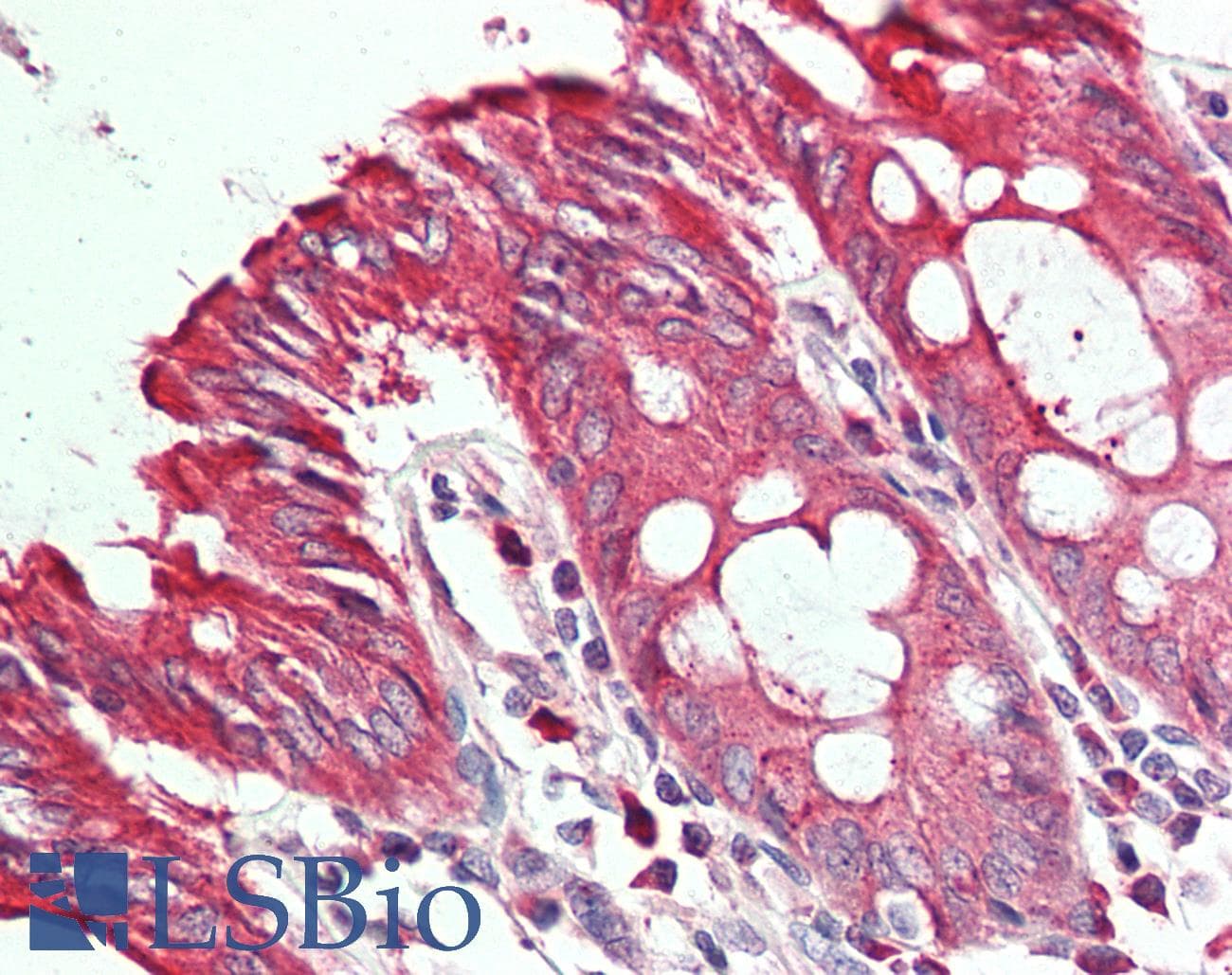 CDH12 / Cadherin 12 Antibody (HRP)