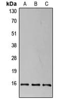 EIF4EBP1 / 4EBP1 Antibody (phospho-Thr37)