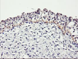 DTNB / Dystrobrevin Beta Antibody (clone OTI3A12)