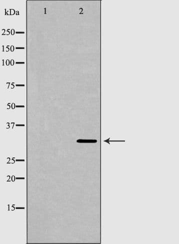 TPM1 / Tropomyosin Antibody