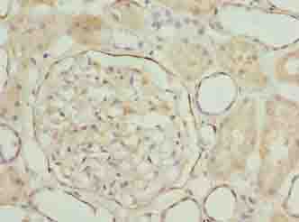 LRRN2 / GAC1 Antibody