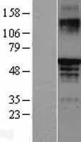 Human ESR2 / ER Beta Protein (Over-Expression Lysate Myc-DDK (Flag))