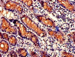 Polyclonal Rabbit anti-Human SNX27 Antibody (IHC, WB)