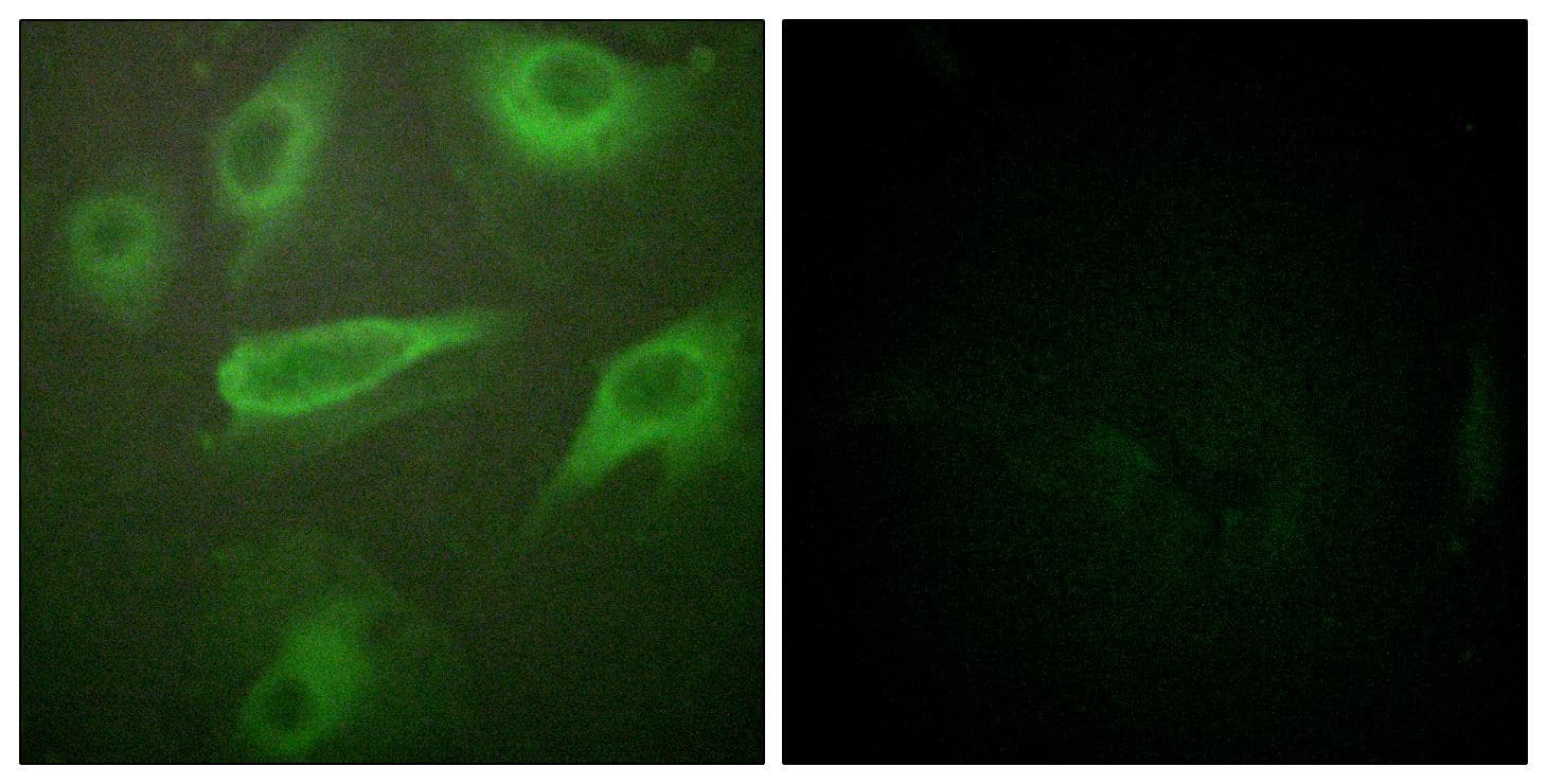 IL4R / CD124 Antibody (phospho-Tyr497)