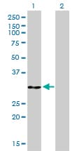 IHC-plus™ Monoclonal Mouse anti-Human ANXA5 / Annexin V Antibody (clone 1F4-1A5, IHC, IF, WB)