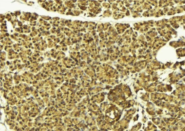 Polyclonal Rabbit anti-Human HDAC8 Antibody (IHC, IF, WB)