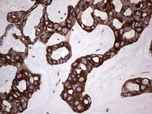 SH3P7 / HIP-55 Antibody (clone OTI6C9, Carrier-free)