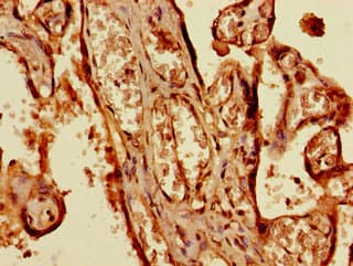 KIAA1811 / BRSK1 Antibody