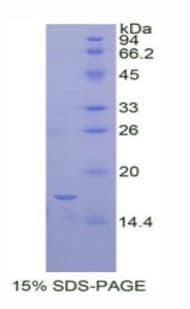 Human IL12RB2 Protein (Recombinant His)
