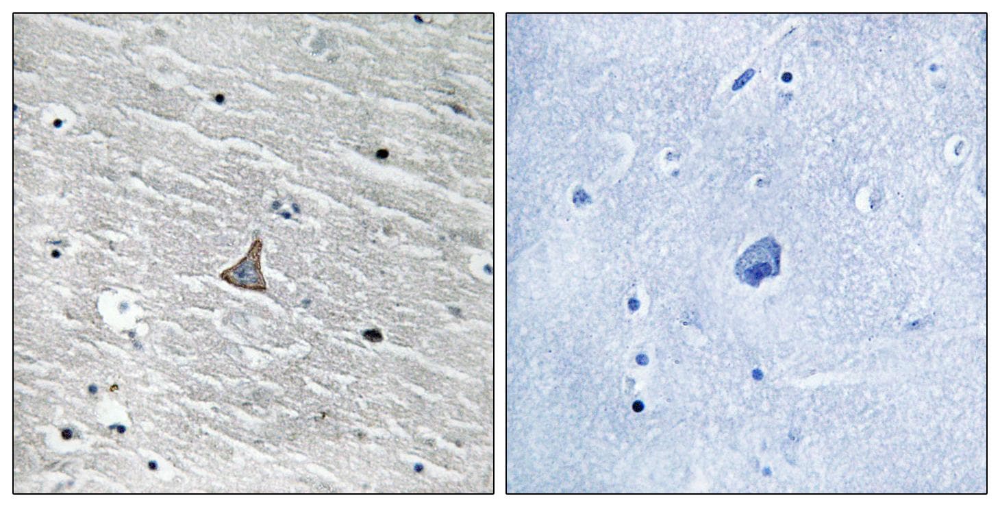 VHL / Von Hippel Lindau Antibody (Ab-68)