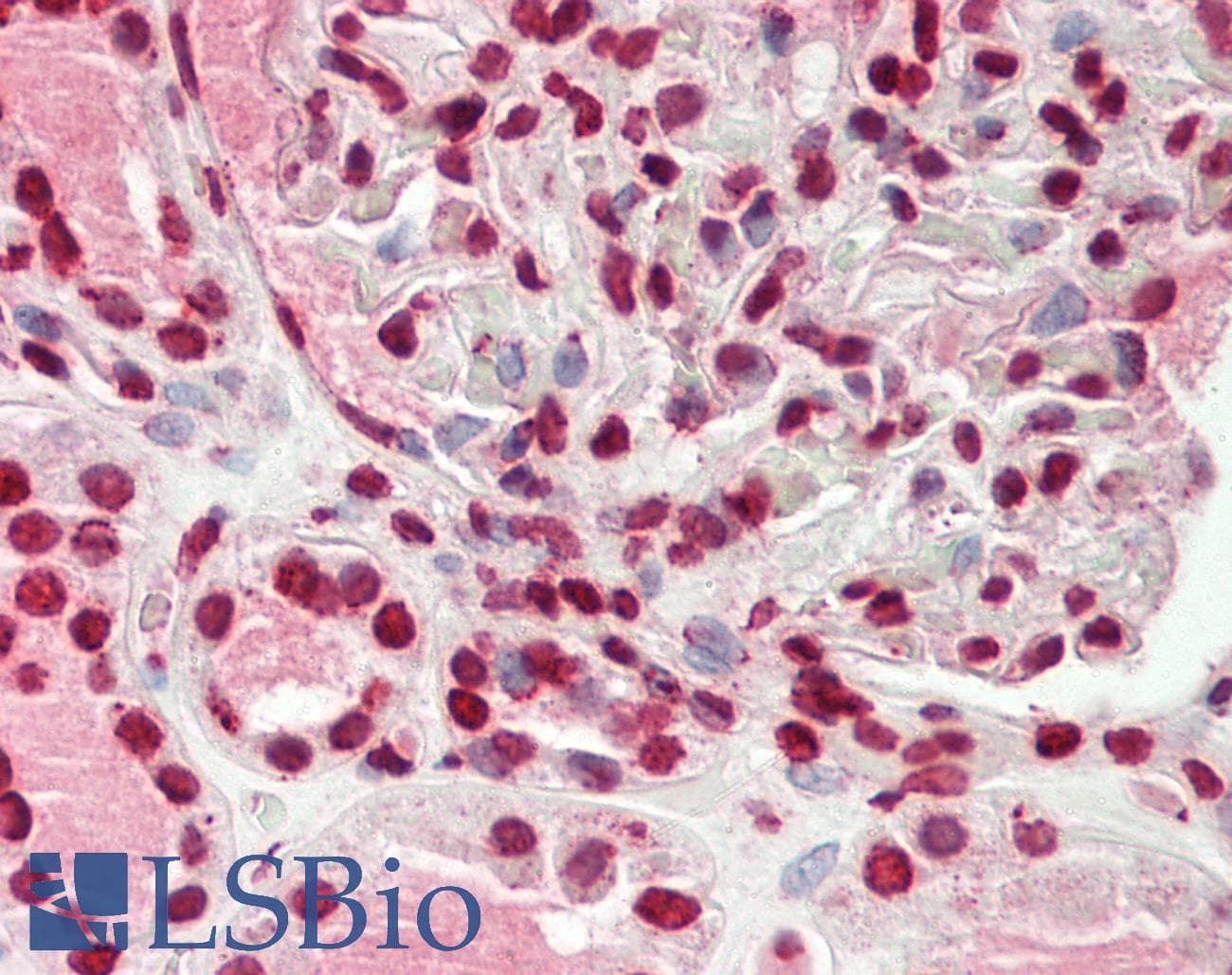 IHC-plus™ Monoclonal Mouse anti-Human WTAP Antibody (clone 1B11, IHC, WB)