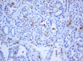 KRT5 / CK5 / Cytokeratin 5 Antibody (Conserved Region, clone OTI1C7, Carrier-free)