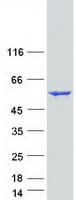 Human GLUD1/Glutamate Dehydrogenase Protein (Recombinant Myc-DDK (Flag))