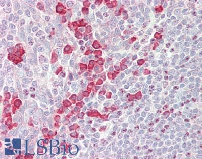 IHC-plus™ DVL2 / Dishevelled 2 Antibody (aa650-700)