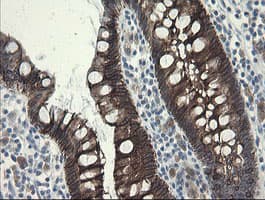 SLA2 / SLAP2 Antibody (clone OTI3A7)
