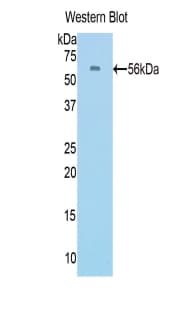 PROC / Protein C Antibody (aa186-437, Biotin)