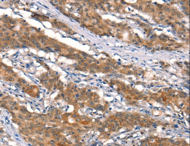 Cullin 4B / CUL4B Antibody