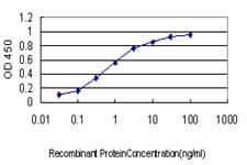 IHC-plus™ YY1 Antibody (clone 2C4)